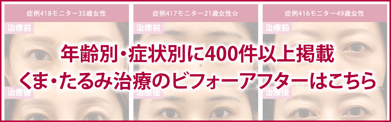 年齢別・症例別に400件以上掲載｜くま・たるみ治療のビフォー・アフター