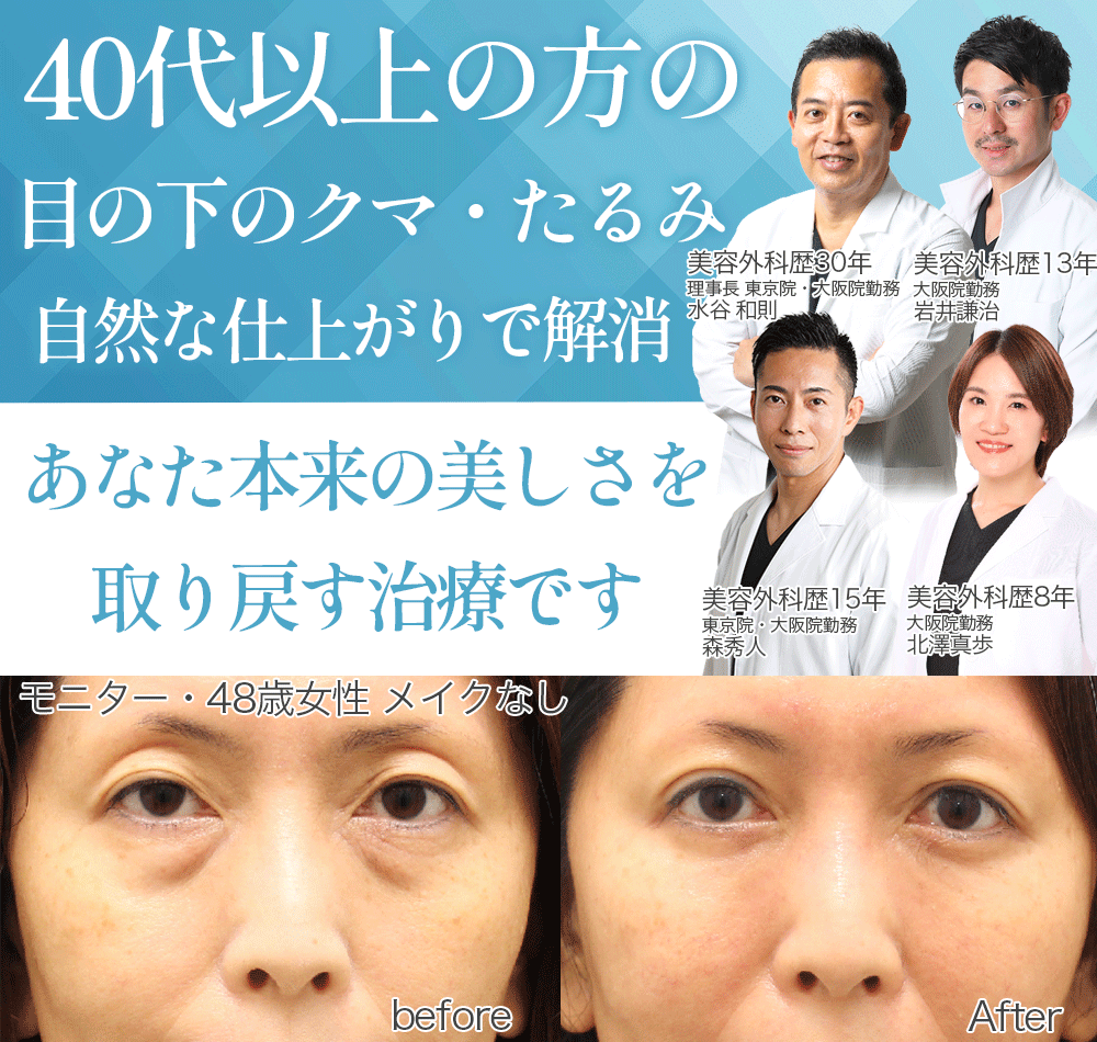 目の下のクマ気になるあなたへ