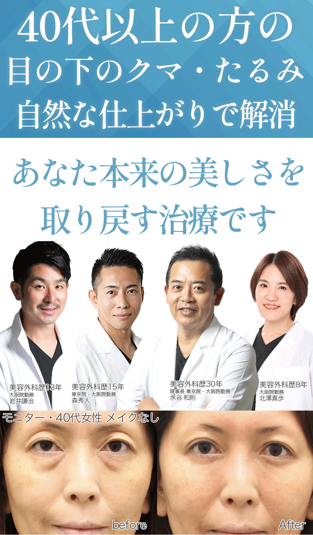 目の下のクマ気になるあなたへ