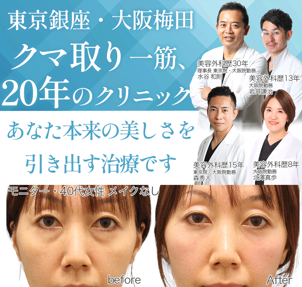 目の下のクマ気になるあなたへ