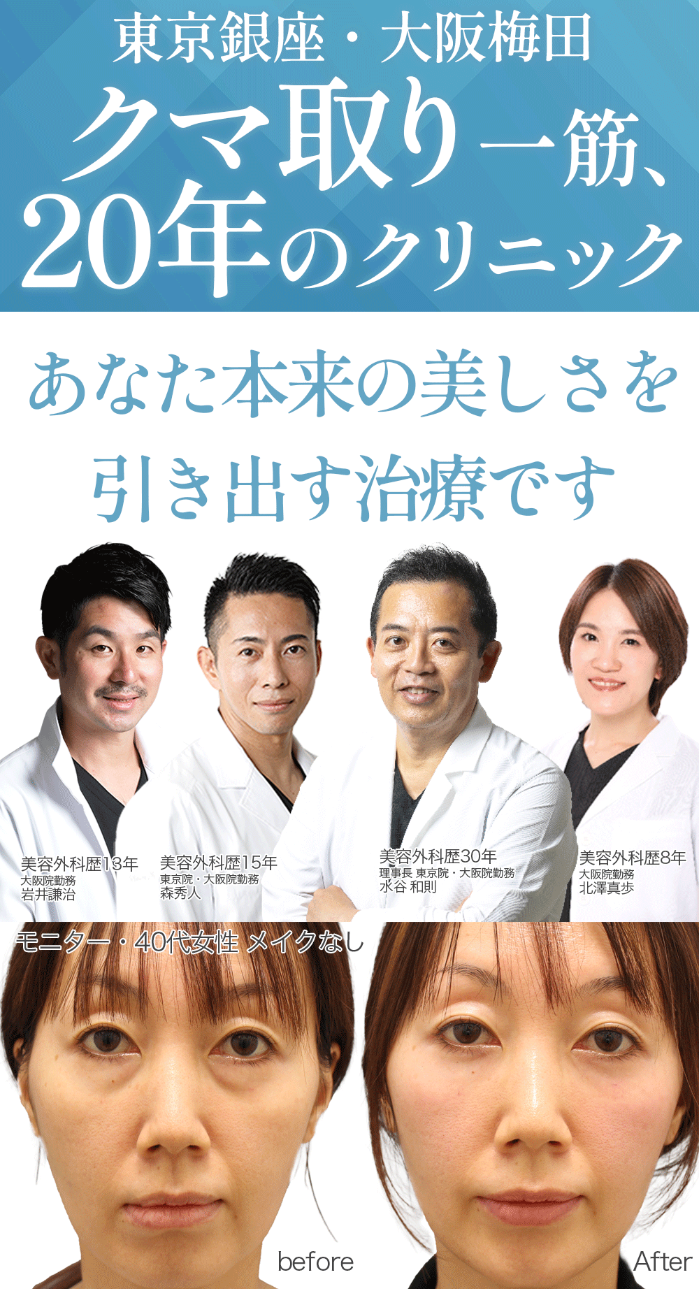 目の下のクマ気になるあなたへ