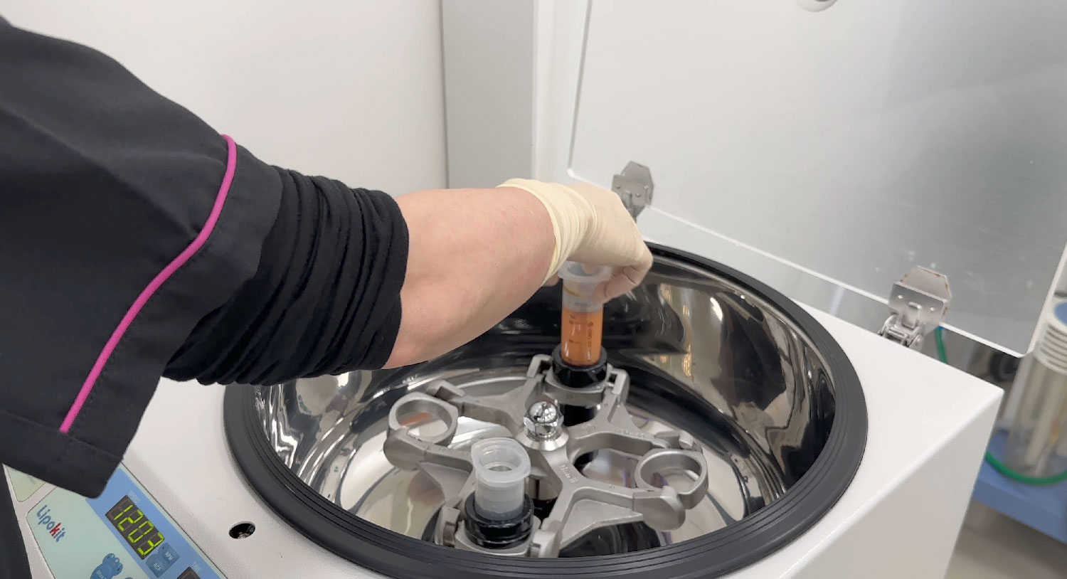 注入脂肪がフレッシュ